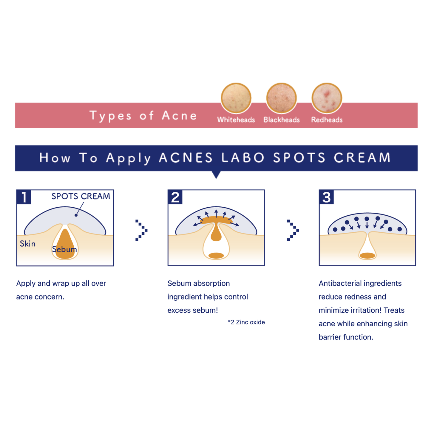 ACNES LABO Acne Patches On-the-Spot Treatment