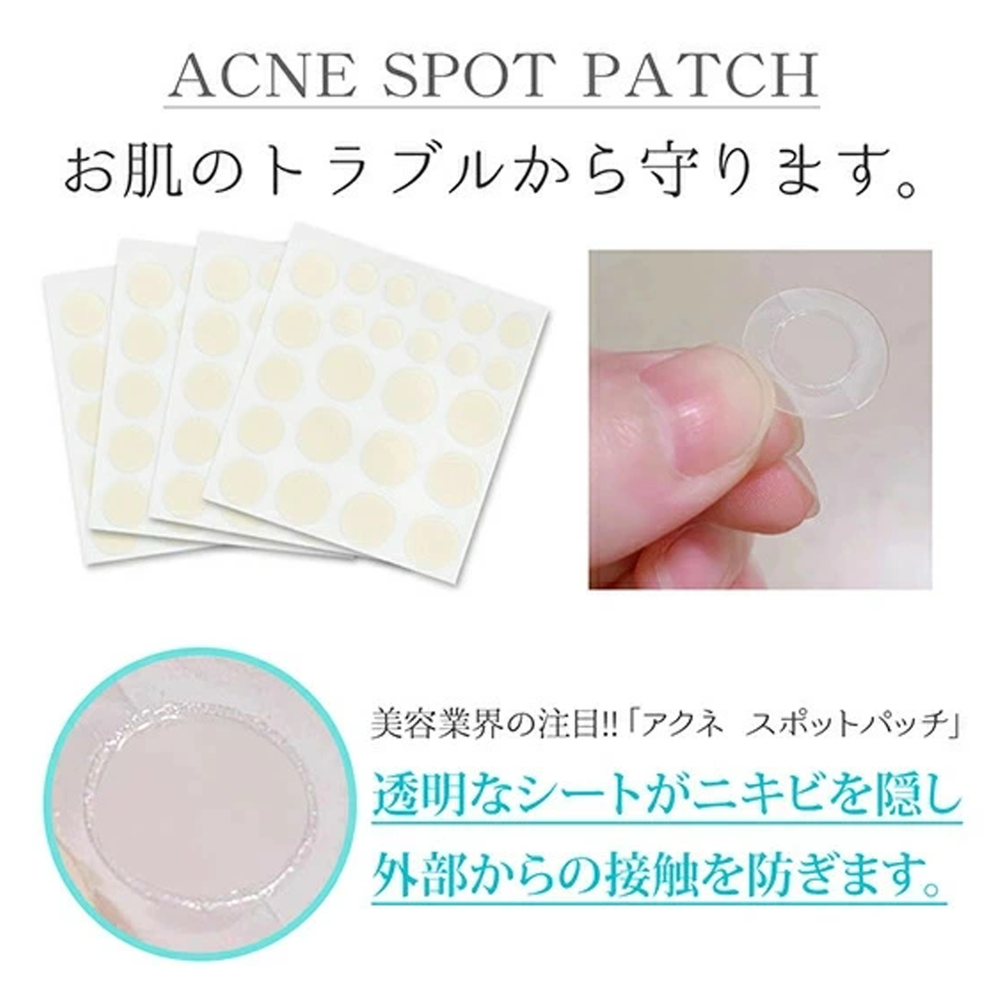 NOSTEEZ Acne Patches 3 Sizes 96 Patches